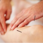 acupuncture knee